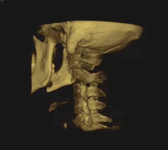 CBCT cone beam imaging scanner used for precise chiropractic care in Oceanside