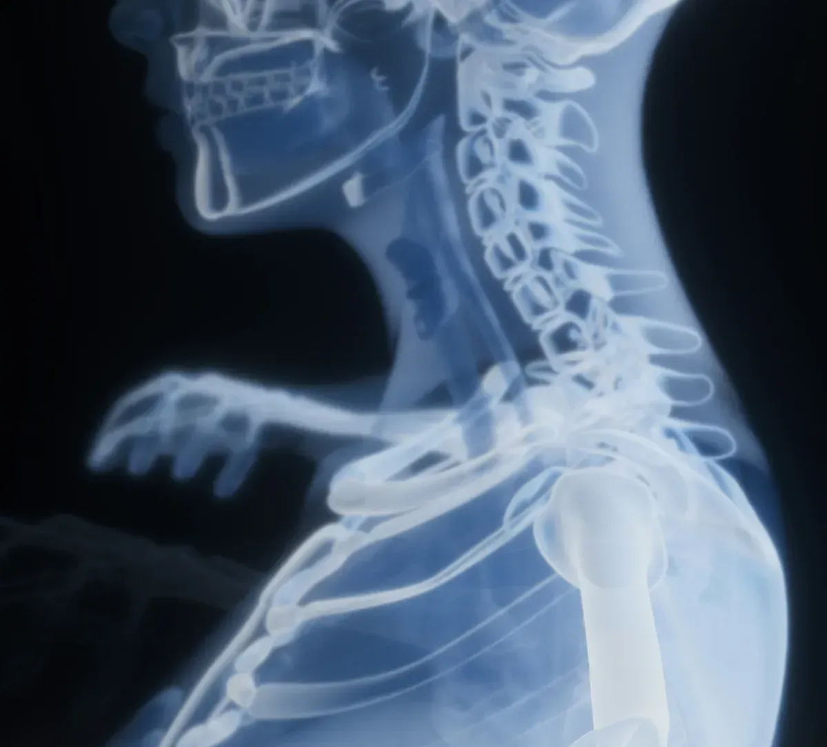 X-ray style illustration of the neck, upper back, and rib cage, the structures breathing muscles attach to